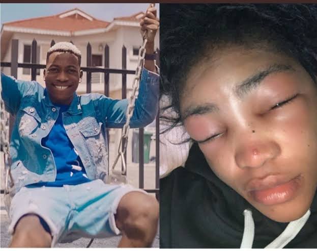 “You better be ready” – Rapper Lil Frosh accused of beating his girlfriend (Photos)