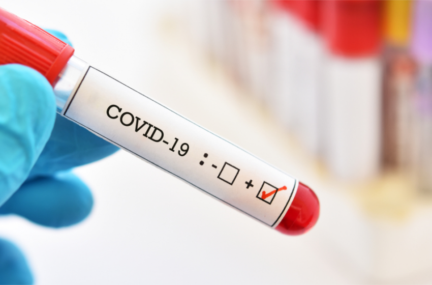 The US passes over 30 million coronavirus cases