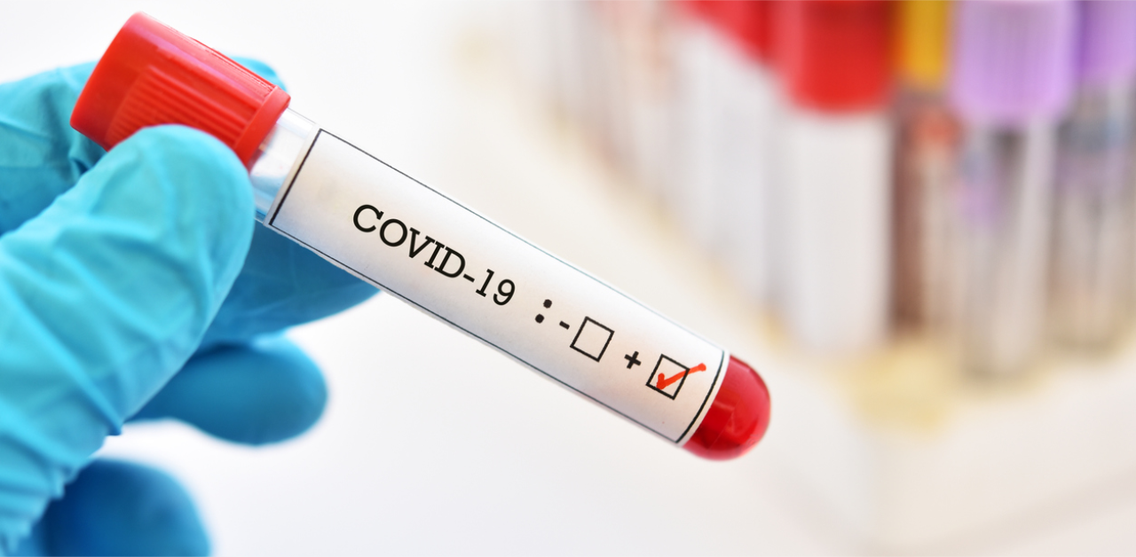 The US passes over 30 million coronavirus cases