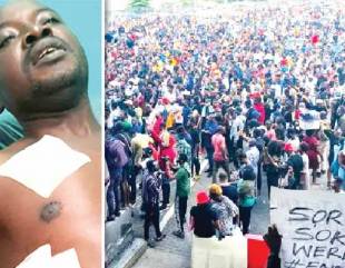 ‘I Will Join #EndSARS Protest Again Despite Being Shot By Soldiers Last Year’ (Pix)