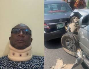 ”I Was Saved By The Seat Belt” – Dr Joe Abah Reveals He Was Involved In An Accident On Third Mainland Bridge