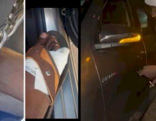 The rising cost of living allegedly causing Zimbabwean citizens to cut and sell off their toes [Photos]