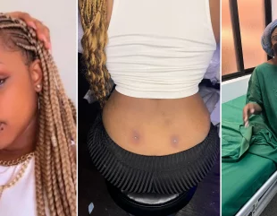 Lady lands in hospital after getting a back dimple piercing