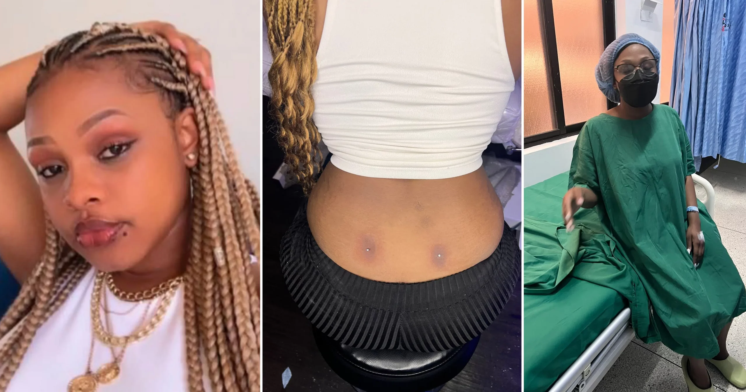 Lady lands in hospital after getting a back dimple piercing