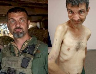 See shocking before and after photos of Ukrainian soldier recently released in a prisoner swap after four months in Russian captivity