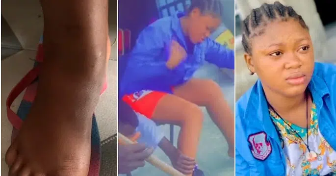 “Avoid fake friends” – Lady shares survival story after getting poisoned by a female friend (Video)