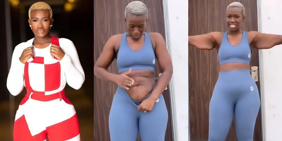 Real Warri Pikin shares challenges after undergoing gastric sleeve surgery